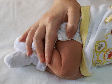 An image of a newborn, with an adult’s hand gently bending the newborn’s legs. This positioning technique is called facilitated tucking. Image credit: Kucukoglu S, Kurt S, Aytekin A. Ital J Pediatr. 2015;41:61. doi: 10.1186/s13052-015-0168-9. License: CC BY 4.0